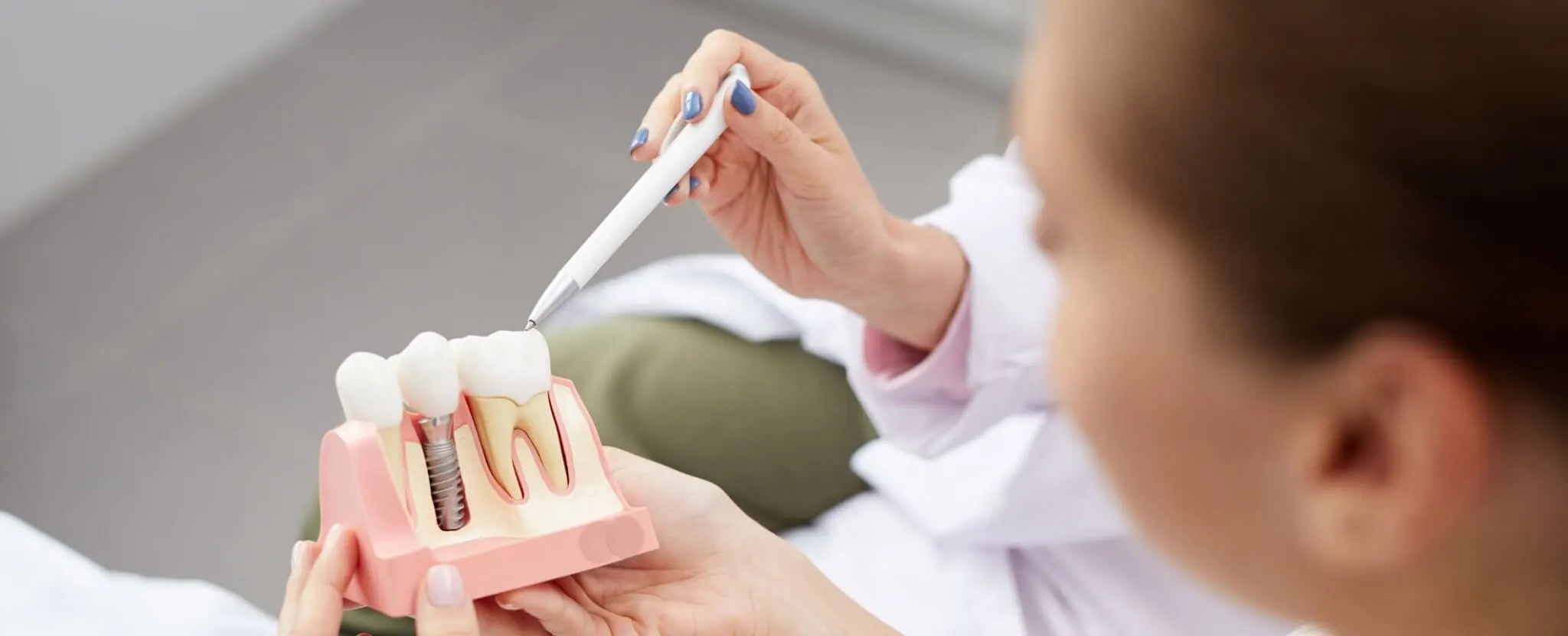 Close-up of a dental professional using a pen to point at a tooth model showing a dental implant and natural teeth during a patient consultation.