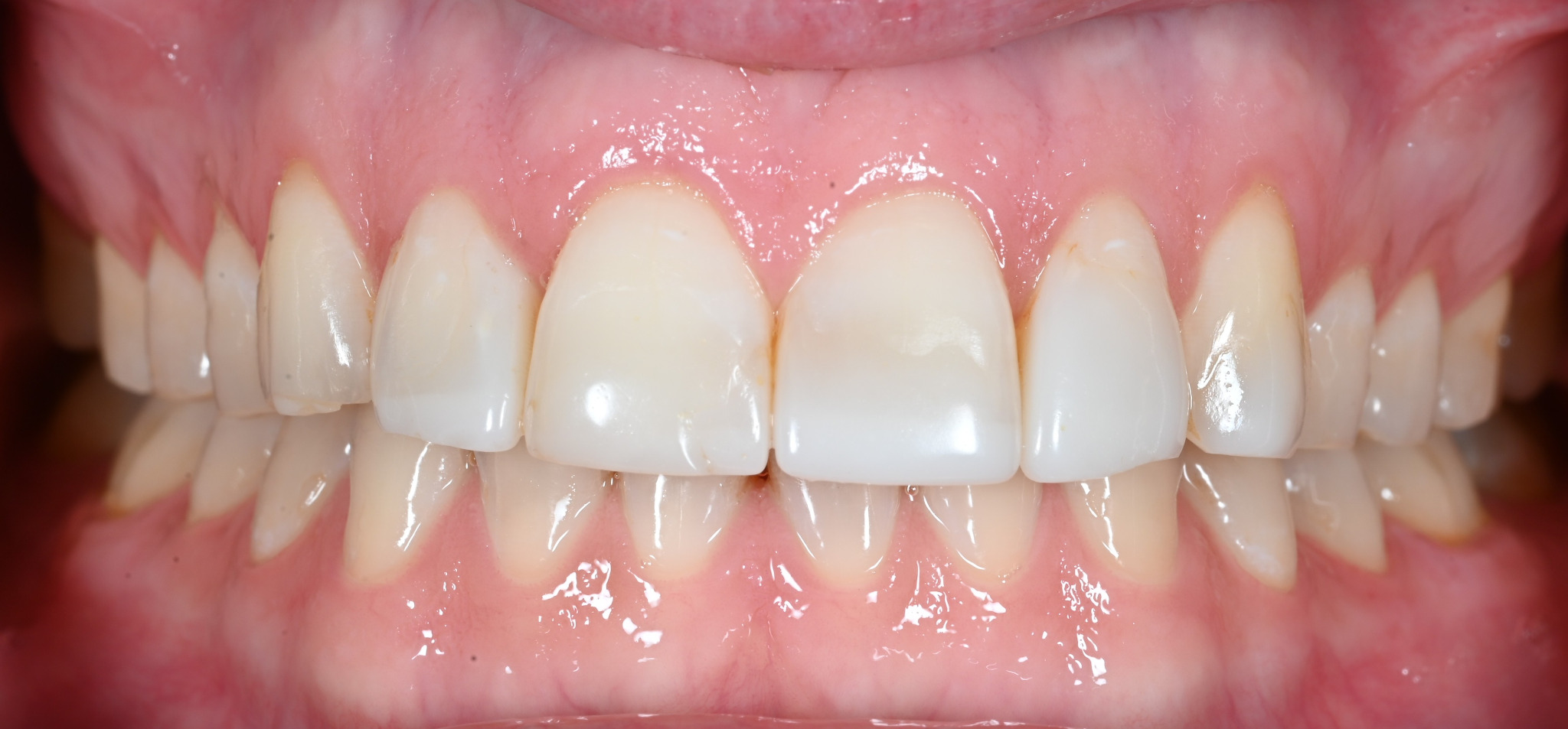 First dental photograph